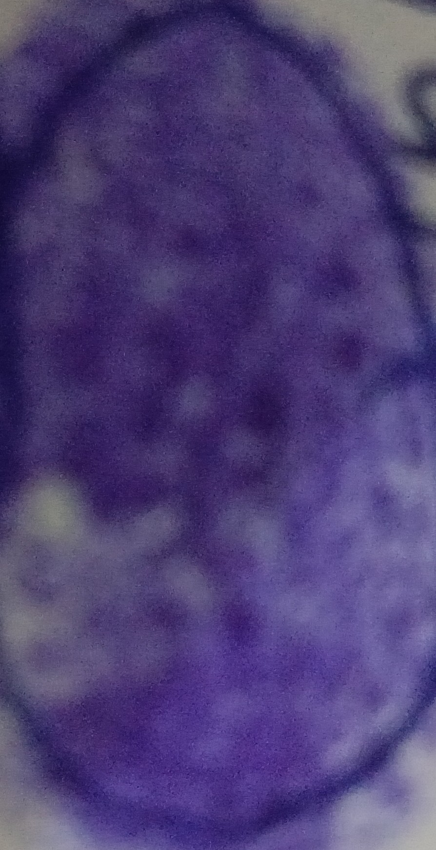 13augitem