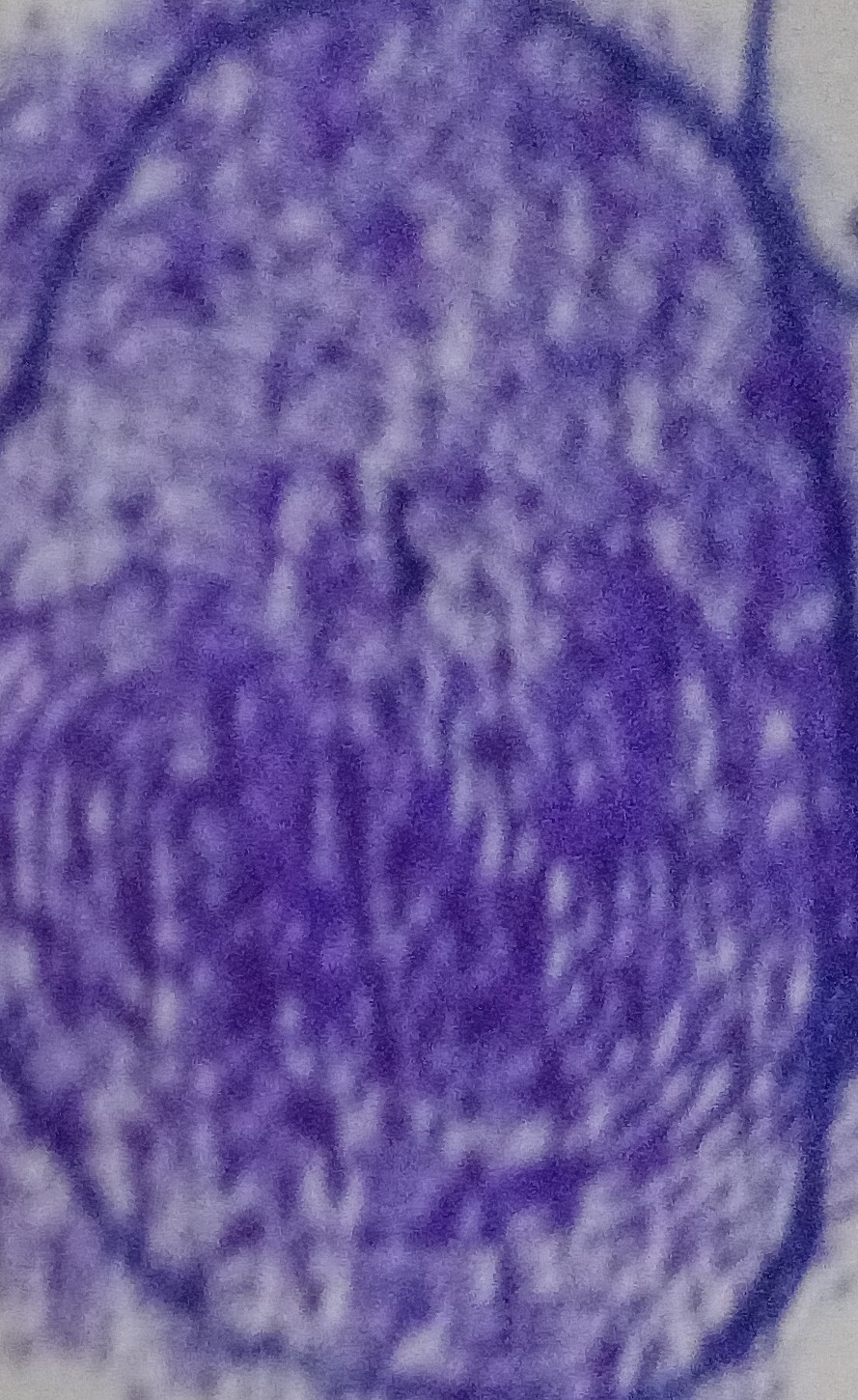 13augitem